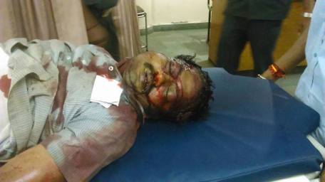  Vishwanath - the Hindu man hacked to death brutally by Islamic cadres of PFI in Shimoga. 